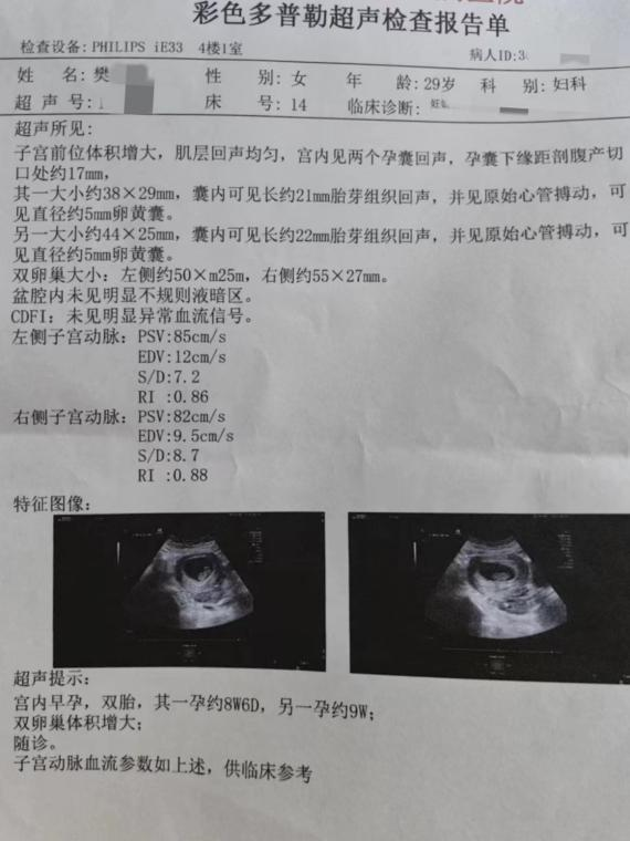 震惊！打工人简历惊现‘多囊不能怀孕’，职场潜规则要被打破？